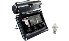 Exactech - Model GPS - Guided Personalized Surgery System