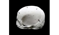 StarPore - Cranial Implant