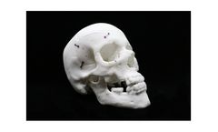 StarPore - Polymer Surgical Facial Implants