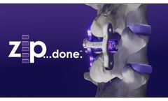ZIP Surgical Technique Guide - Animation - Video