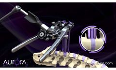 Compass 4D Retractor System - Video