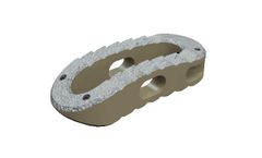 EOS - Model TLIF - Interbody Fusion Cage System