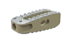 ECHO - Model PLIF - Interbody Fusion Cage System