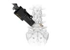 Karma / Karma - Model MIS - Novel Metal-Free Cortico-Pedicular Fixation System