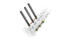 Overwatch - Model MIS - Minimally Invasive Posterior Thoracolumbar Fixation System