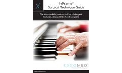 InFrame Brochure