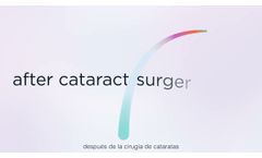 Light Adjustable Lens Lobby Video Without Music - Video