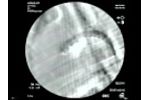 Porcine Endograft Model - Video