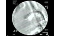 Porcine Endograft Model - Video
