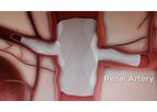Red Vascular - Branch Graft