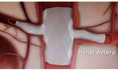 Red Vascular - Branch Graft