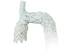 Endospan NEXUS - Aortic Arch Stent Graft System