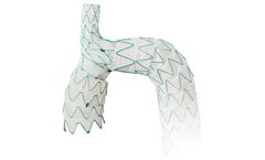 Endospan NEXUS - Aortic Arch Stent Graft System