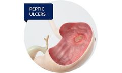 Medical solutions for gastroenterological area