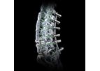 Biedermann - Model MOSS VRS - Pedicle Screw Sytems