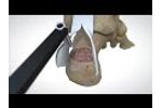 OSSIOfiber Suture Anchor Animation - Video