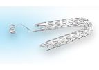 Allium - Ureteric Stents