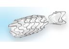 Allium - Round Posterior Stent (RPS)