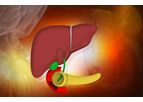 Allium - Biliary Stricture