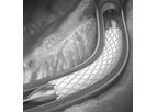 Aran - PTFE Covered Stents