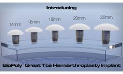 BioPoly Great Toe Hemiarthroplasty Implant - Surgical Technique - Video