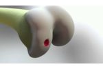 BioPoly RS Knee System Animation - Video