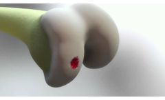 BioPoly RS Knee System Animation - Video