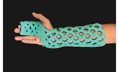 FlexiOH - Radial Gutter Immobilizer