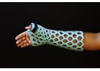 FlexiOH - Long Thumb Spica Immobilizer