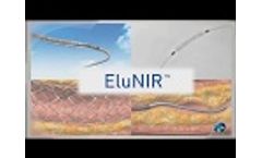 eDES by Medinol - Video