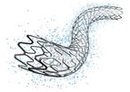 Medinol - Model EluNIR - Ridaforolimus Eluting Coronary Stent System