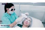 Trattamento Laser Con Lumix Ultra Fisioline - Video