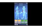 Electrotherapy: Video Tutorial Modulo/Modulo Plus - Video