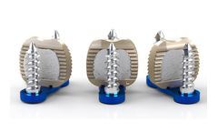 Lape Medical - Dual Plate