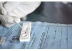 Dutch Diagnostics - Bladder Tumor (BT) Test Kit