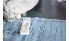 Dutch Diagnostics - Bladder Tumor (BT) Test Kit