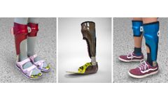 Upper and Lower Limbs Orthotics Service