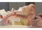 TubaClean - Probing and Fushing  Catheter for the Tuba Eustachii