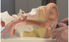 TubaClean - Probing and Fushing  Catheter for the Tuba Eustachii