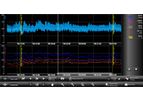 Finapres NOVA - Measurement Review Software