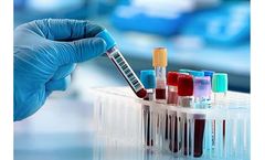 Celemics - Model CES - G-Mendeliome Clinical Exome Sequencing Panel