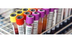 Celemics - Targeted RNA Sequencing Panel