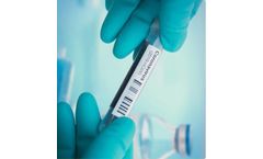 Quark - Dual Function Digital PCR Kit