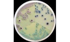 Condalab - Model 2207 - Candida Chromogenic Agar