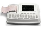 Edan - Model SE-601 Series - 6-Channel ECG for Cardiovascular Diagnostics System