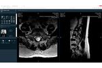 RadiBox ultrafast teleradiology platform - Video
