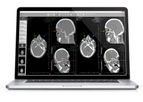 AlleRad - Version Rbox - Teleradiology Software for Radiology Image Sharing