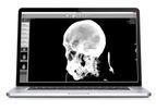 AlleRad - Version DICOM Reader-EXHB - Medical Imaging Software