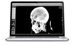 AlleRad - Version DICOM Reader-EXHB - Medical Imaging Software