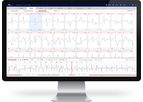 AT-Report - AI-Based Accurate ECG Analysis Software
